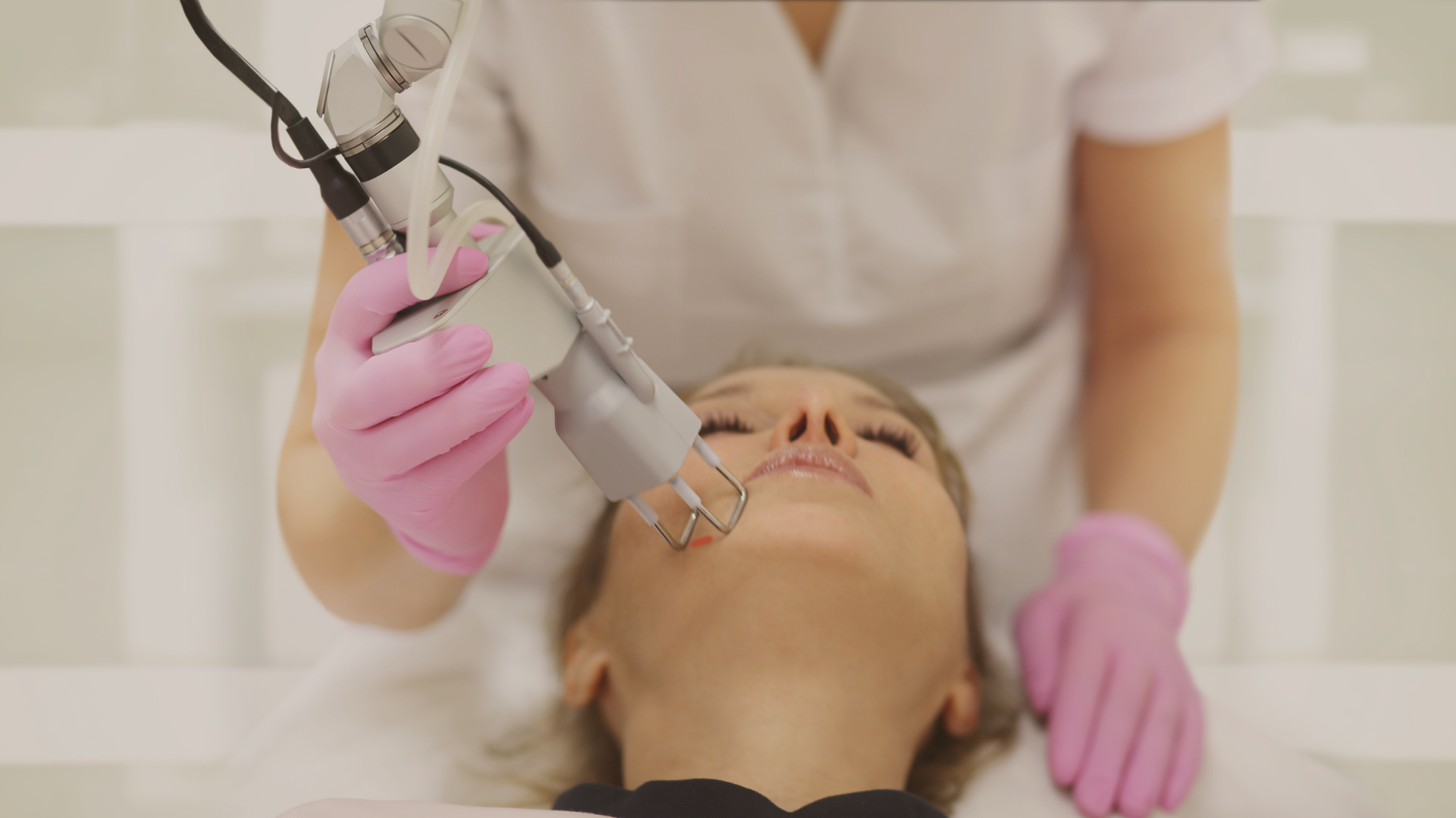 O que é Resurfacing a Laser?