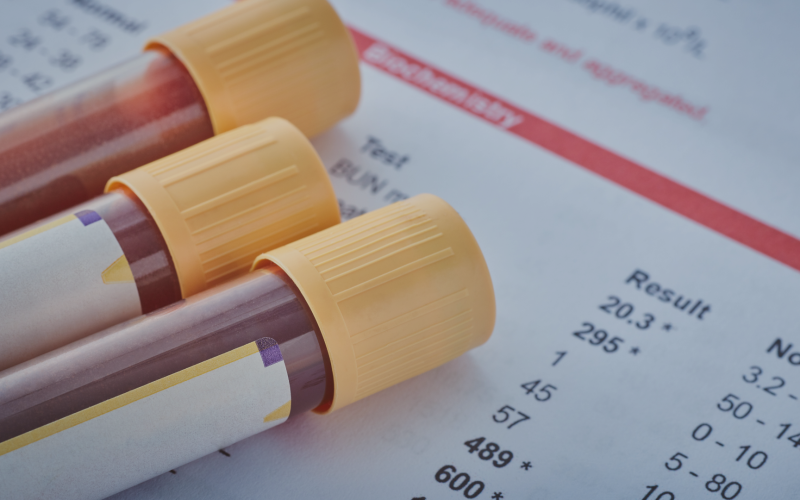 Exames Laboratoriais na Estética