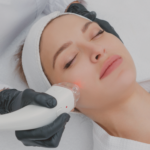 Laser Lavieen: O Que é ?