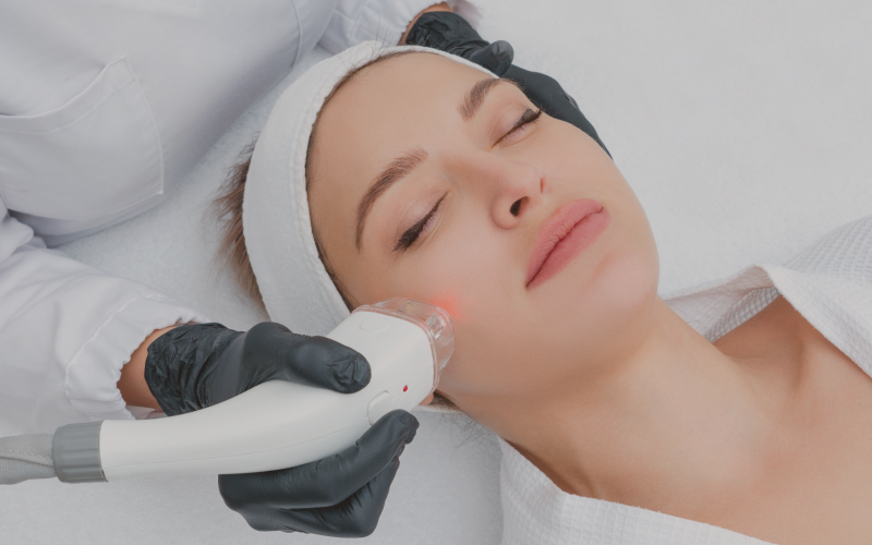 Laser Lavieen: O Que é ?