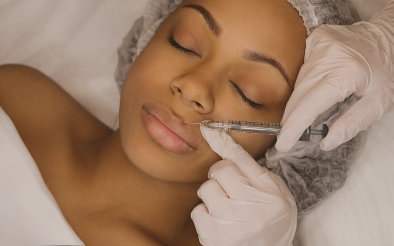 O que é Preenchimento Labial?