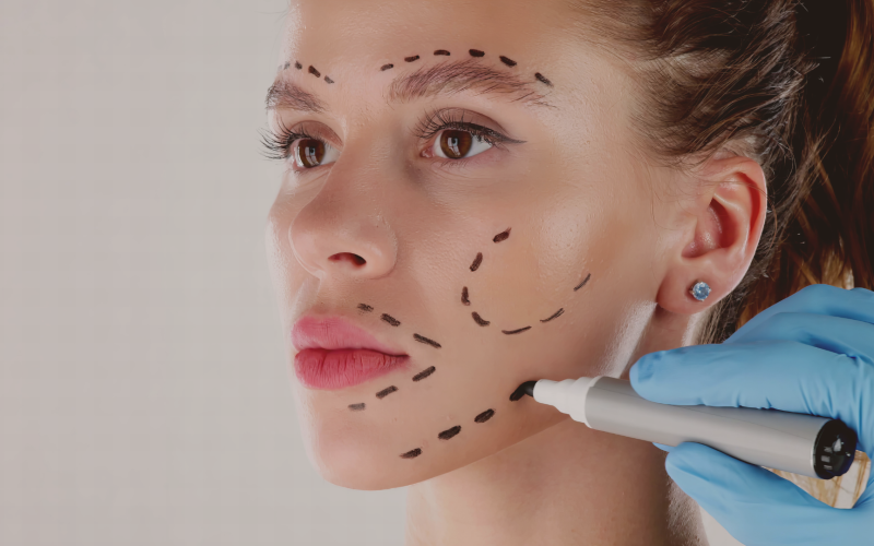 O que é Harmonização Facial?