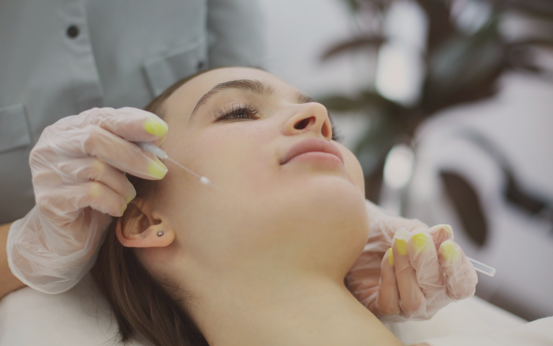 O que são Fios Silhuete?