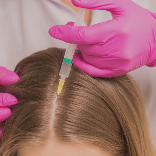 O que é Mesoterapia Capilar?