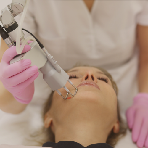 O que é Resurfacing a Laser?