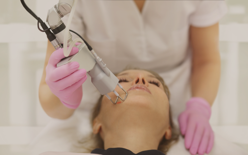 O que é Resurfacing a Laser?