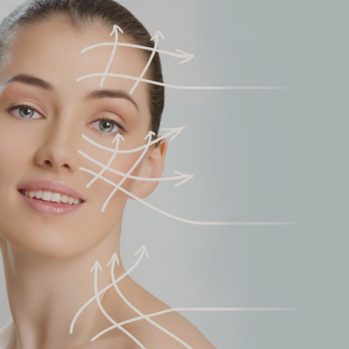 O que são Fios de Sustentação?