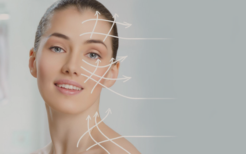 O que são Fios de Sustentação?