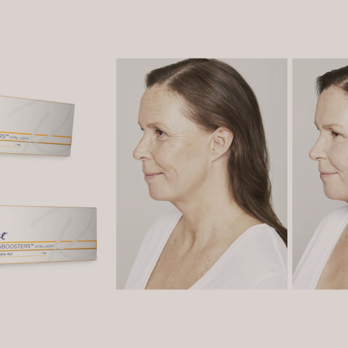 O que é Skin Booster?