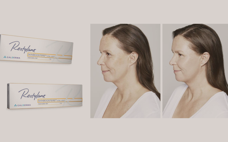 O que é Skin Booster?